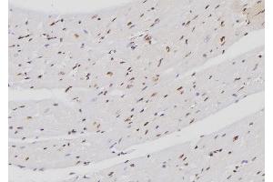 ABIN6257188 and ABIN6274272 at 1/100 staining Mouse heart tissue by IHC-P. (FXR2 anticorps  (C-Term))