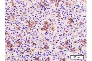 Formalin-fixed and paraffin embedded human pancreas labeled with Anti-TROP2/TACD2 Polyclonal Antibody, Unconjugated (ABIN715646) at 1:200 followed by conjugation to the secondary antibody and DAB staining