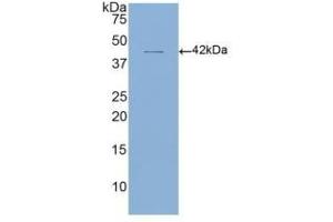 WB of Protein Standard: different control antibodies  against Highly purified E. (CD4 Kit ELISA)