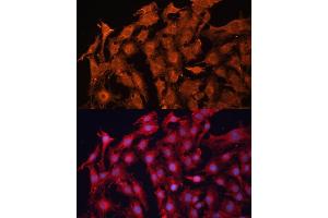 Immunofluorescence analysis of C6 cells using P Glycoprotein antibody (ABIN6129943, ABIN6136341, ABIN6136344 and ABIN6216612) at dilution of 1:100. (ABCB1 anticorps  (AA 630-710))