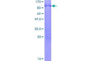 Image no. 1 for Calcium Channel, Voltage-Dependent, beta 4 Subunit (CACNB4) (AA 1-520) protein (GST tag) (ABIN1347836)