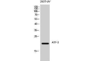Western Blotting (WB) image for anti-Activating Transcription Factor 3 (ATF3) (C-Term) antibody (ABIN3183418) (ATF3 anticorps  (C-Term))