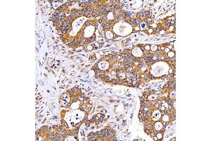 IHC analysis of Rab4/RAB4A using anti-Rab4/RAB4A antibody (ABIN7599733). (Rab4 anticorps  (AA 110-216))