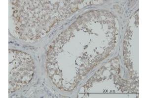 Image no. 1 for anti-Mitogen-Activated Protein Kinase Kinase Kinase 4 (MAP3K4) (AA 1201-1300) antibody (ABIN598811) (MAP3K4 anticorps  (AA 1201-1300))