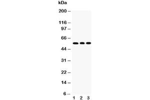 Western blot testing of KLF4 antibody and Lane 1:  HeLa