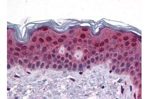 Human Skin: Formalin-Fixed, Paraffin-Embedded (FFPE) (FAM120B anticorps  (C-Term))