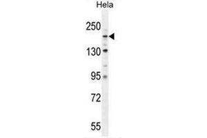 COL4A2 Antibody (N-term) western blot analysis in Hela cell line lysates (35µg/lane). (COL4a2 anticorps  (Chain alpha 2, N-Term))