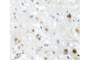 Immunohistochemistry of paraffin-embedded Rat brain using SAFB2 Polyclonal Antibody at dilution of 1:100 (40x lens). (SAFB2 anticorps)
