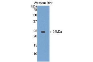 Western Blotting (WB) image for anti-Insulin-Like Growth Factor Binding Protein 6 (IGFBP6) (AA 51-226) antibody (ABIN3208922) (IGFBP6 anticorps  (AA 51-226))