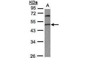 WB Image Sample(30 ug whole cell lysate) A:293T 10% SDS PAGE antibody diluted at 1:1000 (PIGK anticorps)
