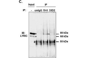 Dengue virus NS1-WD mAb 19-5 but not 33D2 cross-reacts with the LYRIC protein on human endothelial cells.