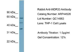 WB Suggested Anti-WDR33  Antibody Titration: 0. (WDR33 anticorps  (N-Term))