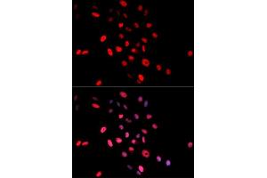 Immunofluorescence analysis of MCF-7 cells using Phospho-Jun-S63 antibody (ABIN5969905). (C-JUN anticorps  (pSer63))