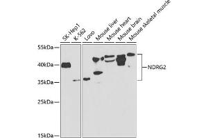 Western blot analysis of extracts of various cell lines, using NDRG2 antibody (ABIN6128325, ABIN6144451, ABIN6144452 and ABIN6220946) at 1:1000 dilution. (NDRG2 anticorps  (AA 138-357))