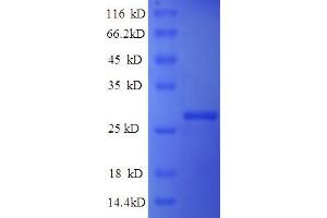 SDS-PAGE (SDS) image for ATPase, H+/K+ Exchanging, beta Polypeptide (ATP4b) (AA 58-291) protein (GST tag) (ABIN5709101)