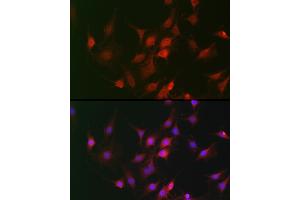 Immunohistochemistry of paraffin-embedded mouse lung using GAPDH Rabbit pAb (ABIN3020537, ABIN3020538 and ABIN3020539) at dilution of 1:100 (40x lens). (GAPDH anticorps  (AA 1-335))