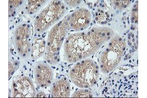 Image no. 1 for anti-Cancer/testis Antigen 1B (CTAG1B) antibody (ABIN1499890) (CTAG1B anticorps)