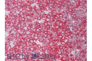 IHC-P analysis of Human Tonsil Tissue, with HE staining. (PCSK9 anticorps  (AA 454-679))