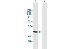 Western Blot analysis of FCN1 expression in transfected 293T cell line by FCN1 MaxPab polyclonal antibody. (FCN1 anticorps  (AA 1-326))