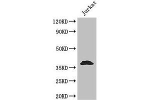 Western Blot Positive WB detected in: Jurkat whole cell lysate All lanes: MCL1 antibody at 3. (MCL-1 anticorps  (AA 19-244))