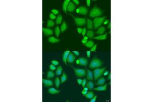 Immunofluorescence analysis of U2OS cells using CAPN2 antibody. (Calpain 2 anticorps  (AA 350-680))