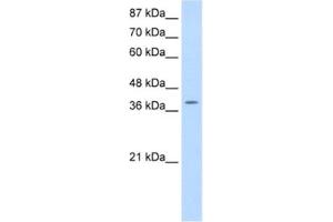 Western Blotting (WB) image for anti-K(lysine) Acetyltransferase 6B (KAT6B) antibody (ABIN2461835) (KAT6B anticorps)
