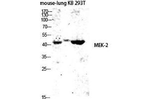 Western Blot (WB) analysis of Mouse Lung KB 293T lysis using MEK-2 antibody. (MEK2 anticorps  (Thr38))