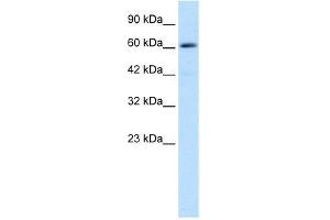 Human Jurkat; WB Suggested Anti-ZNF499 Antibody Titration: 0. (ZBTB45 anticorps  (Middle Region))