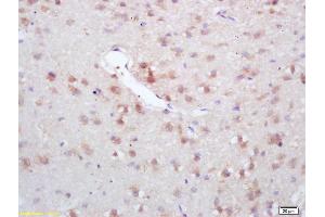 Formalin-fixed and paraffin embedded rat brain labeled with Rabbit Anti GAD67/GAD1 Polyclonal Antibody, Unconjugated (ABIN674679) at 1:200 followed by conjugation to the secondary antibody and DAB staining (GAD anticorps  (AA 455-594))