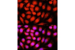 Immunofluorescence analysis of HeLa cells using ACADVL antibody  at dilution of 1:100 (40x lens). (ACADVL anticorps  (AA 1-140))