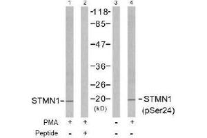 Image no. 2 for anti-Stathmin 1 (STMN1) (pSer24) antibody (ABIN196968) (Stathmin 1 anticorps  (pSer24))