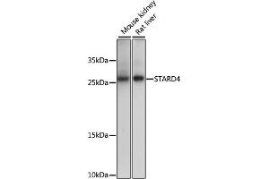 Western blot analysis of extracts of various cell lines, using ST antibody (ABIN7270584) at 1000 dilution. (STARD4 anticorps  (AA 1-100))