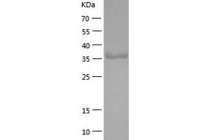 Western Blotting (WB) image for Transmembrane Protease, serine 4 (TMPRSS4) (AA 52-435) protein (His-IF2DI Tag) (ABIN7125479)