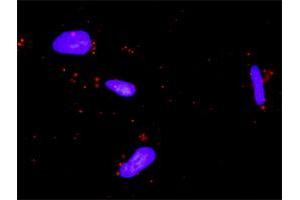 Proximity Ligation Analysis of protein-protein interactions between NFATC4 and MAPK14.