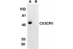 Image no. 1 for anti-Chemokine (C-X3-C Motif) Receptor 1 (CX3CR1) (AA 175-189) antibody (ABIN319015) (CX3CR1 anticorps  (AA 175-189))
