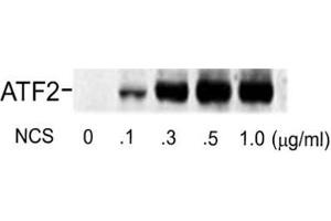 Western blot of human melanoma cells incubated with varying doses of the radiomimetic drug NCS showing specific immuno-labeling of the ~74k ATF2 protein phosphorylated at Ser490 and Ser498. (ATF2 anticorps  (pSer490, pSer498))