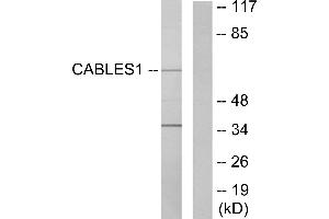 Western blot analysis of extracts from LOVO cells, using Ik3-1 antibody. (CABLES1 anticorps)