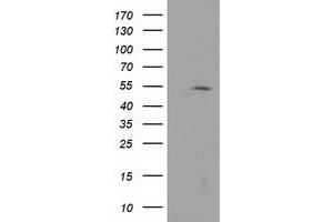 Western Blotting (WB) image for anti-Histone Deacetylase 1 (HDAC1) antibody (ABIN1498605) (HDAC1 anticorps)