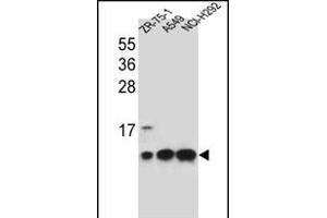 COX6B1 Antibody (C-term) (ABIN656270 and ABIN2845582) western blot analysis in ZR-75-1,A549,NCI- cell line lysates (35 μg/lane). (COX6B1 anticorps  (C-Term))