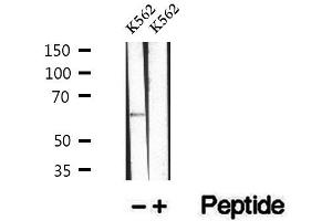 Western blot analysis of extracts of K562 cells, using Phospho-Beclin-1 (Ser15) Antibody.