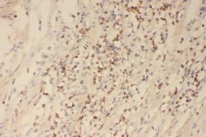 IHC analysis of Profilin 1 using anti-Profilin 1 antibody (ABIN3043603). (PFN1 anticorps  (C-Term))