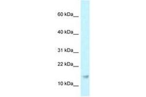 Image no. 1 for anti-Ribonuclease P/MRP 21kDa Subunit (RPP21) (AA 69-118) antibody (ABIN6747773) (RPP21 anticorps  (AA 69-118))