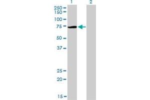 Western Blot analysis of PIAS3 expression in transfected 293T cell line by PIAS3 monoclonal antibody (M03), clone 4F12.