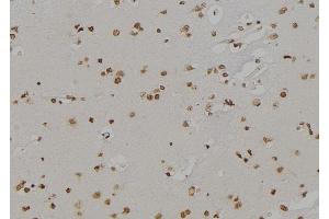 ABIN6259891 and ABIN6277140 at 1/100 staining Human brain tissue by IHC-P. (ALOX5 anticorps  (C-Term))