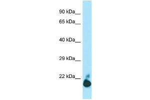 WB Suggested Anti-TIGIT Antibody Titration: 1. (TIGIT anticorps  (C-Term))