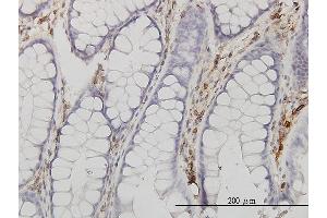 Immunoperoxidase of monoclonal antibody to ANXA5 on formalin-fixed paraffin-embedded human colon. (Annexin V anticorps  (AA 1-320))