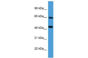 Western Blotting (WB) image for anti-Collagen, Type VIII, alpha 2 (COL8A2) (Middle Region) antibody (ABIN2788308) (COL8a2 anticorps  (Middle Region))