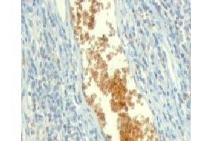 Formalin-fixed, paraffin-embedded human tonsil stained with AMPD3 antibody (clone ETAD3-1). (AMPD3 anticorps)