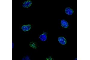 Immunofluorescence (IF) image for anti-Nucleoporin 214kDa (NUP214) (AA 1250-1300) antibody (ABIN7448921) (NUP214 anticorps  (AA 1250-1300))