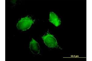 Immunofluorescence of purified MaxPab antibody to HNRPD on HeLa cell.